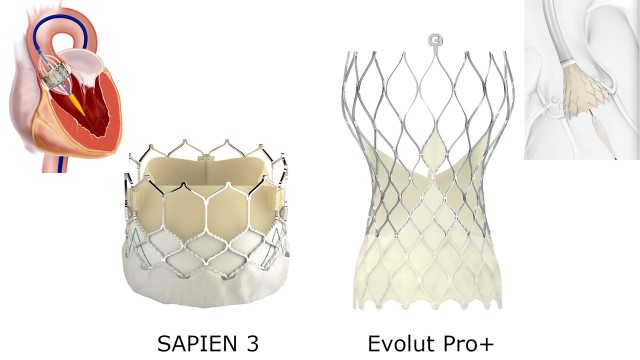 図４：SAPIEN3はウシの心膜で、Evolutシリーズはブタの心膜でできています