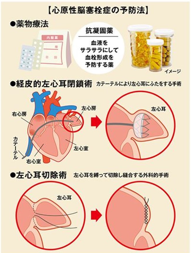 図： 心原性塞栓症予防の概略