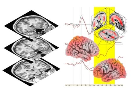 図２：当科では、最新の画像解析により脳の構造や機能を評価します