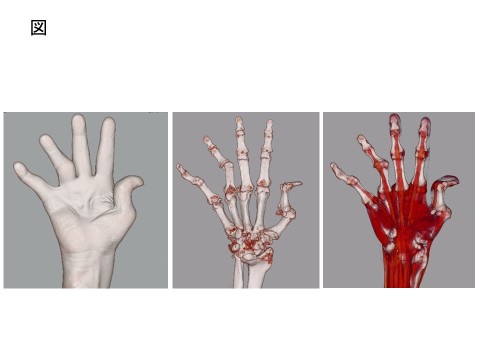 図：骨と腱を描出した3次元CT（手、骨、屈筋腱）