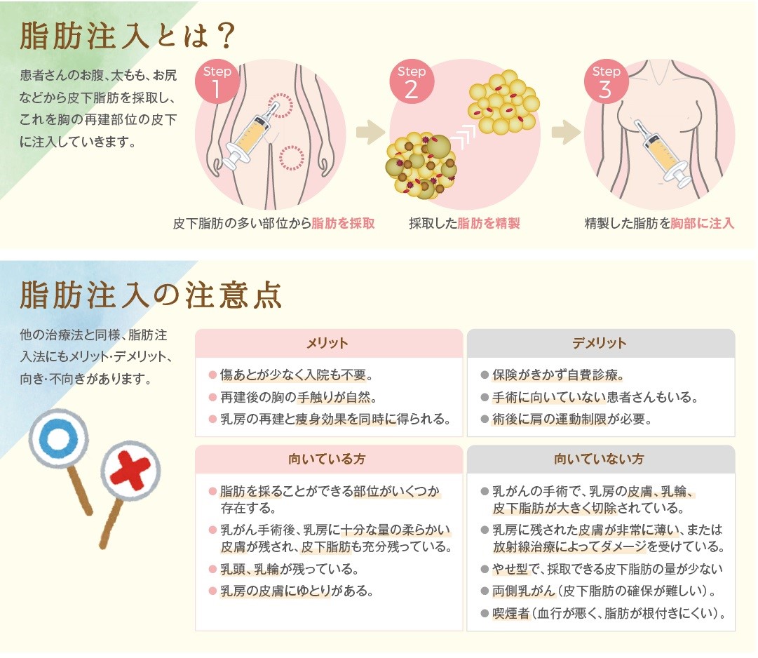 図２：脂肪注入で用いる脂肪の種類