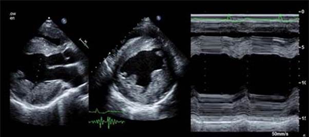 心臓超音波検査（経胸壁・経食道）