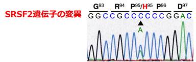 SRSF2遺伝子の変 異